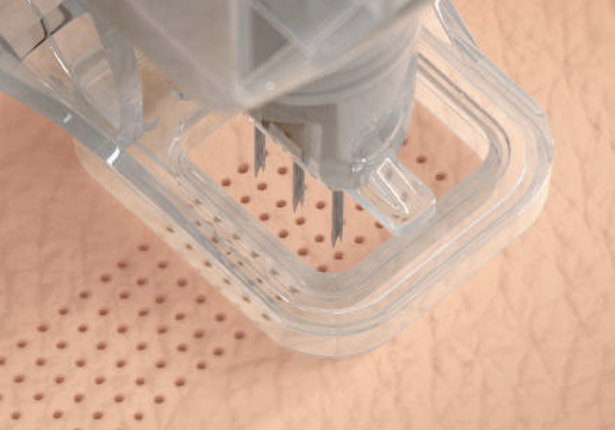 Ellacor Microcoring and Why Tighter Skin Might Not Mean What You Think